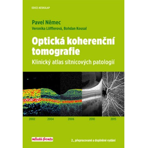 Optická kohereční tomografie | Bohdan Kousal, Veronika Löfflerová, Pavel Němec