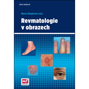 Revmatologie v obrazech | Marta Olejárová