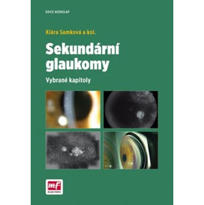 Sekundární glaukomy | Klára Samková