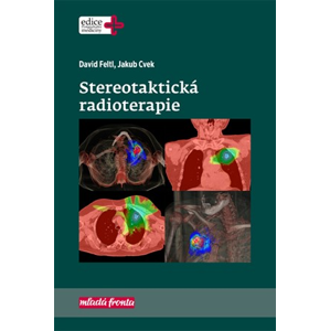 Stereotaktická radioterapie | David Feltl, Jakub Cvek
